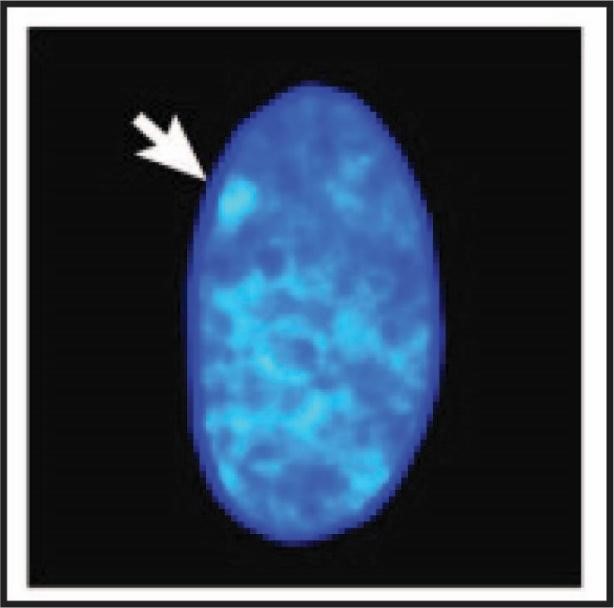 2.18_Evidence_for_X_Chromosome_Inactivation.jpg