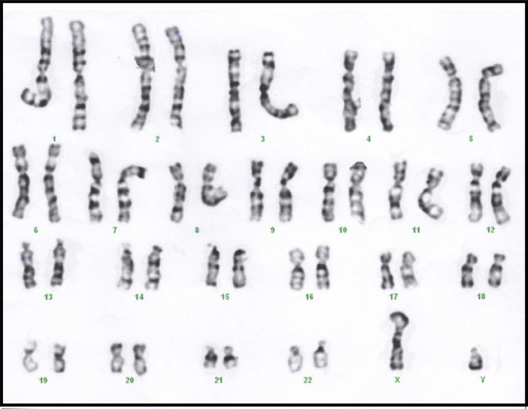 2.9_Karyotype_of_Human_Male.jpg