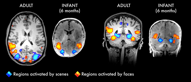 Brain MRIs that show similar regions activated by adult brains and infant brains while looking at either scenes of faces.