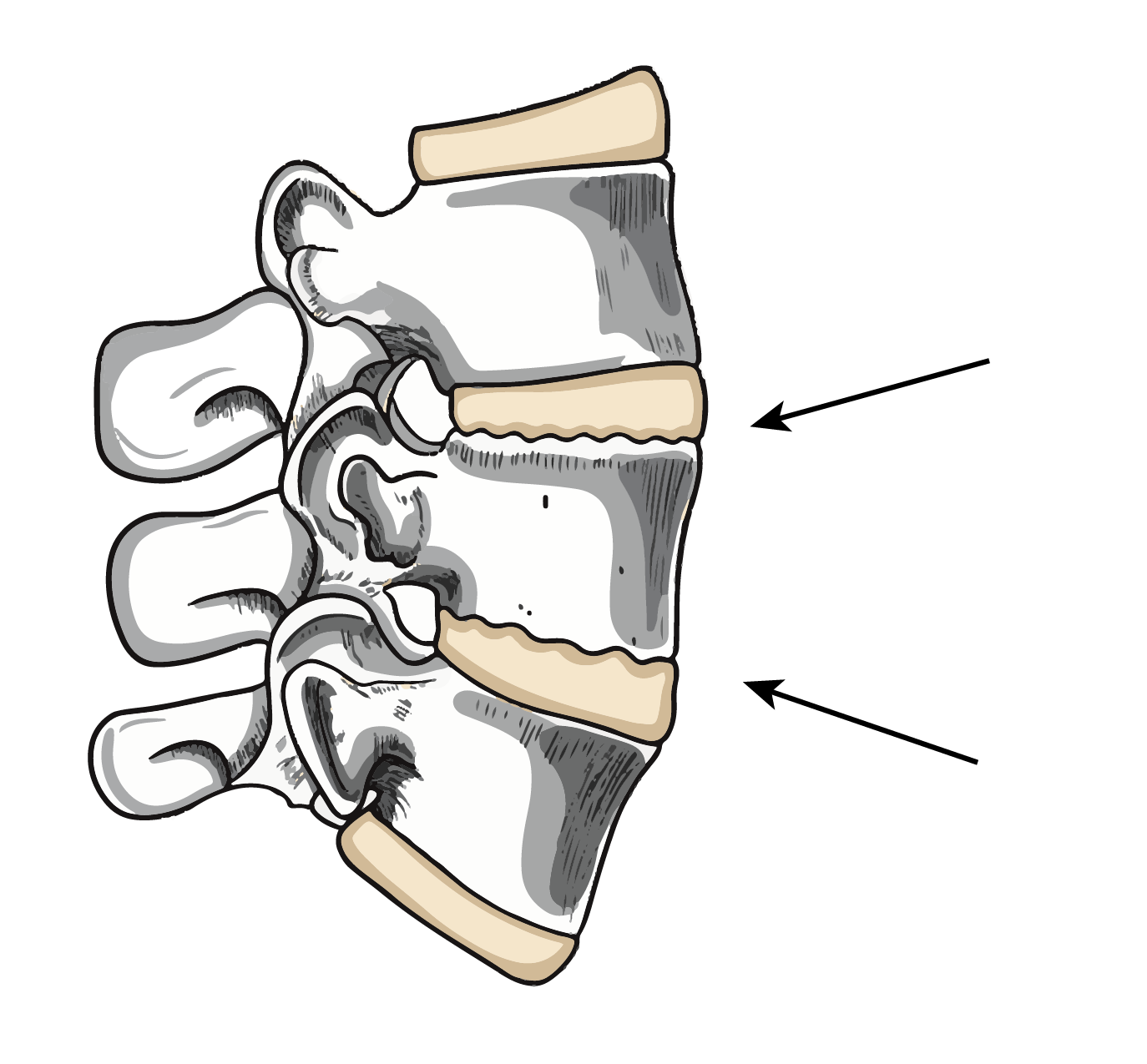 ../New%20Images/Section%2001/Osteophyte%20Formation.png